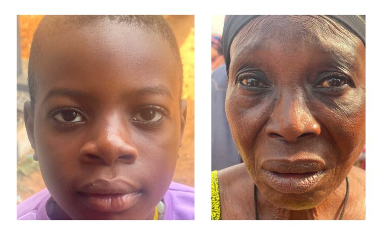 EXPANDING ACCESS TO EYE CARE: Community Health Outreach Initiative Report